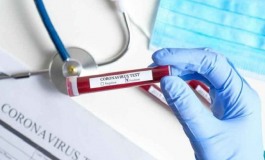 Coronavirus Abruzzo, Asl 1 autorizza esecuzione tamponi-test all'ospedale di Castel di Sangro